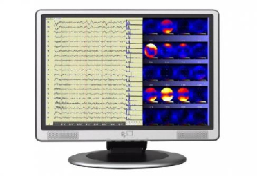 Software BioTrace Nexus 32